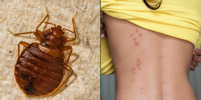 bedbugs all you need to know